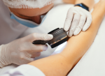 Melanoma Week: El paso a paso para prevenir el cáncer de piel más agresivo